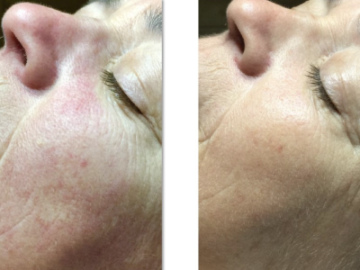 Screenshot 2025-03-04 at 4.37.21 PM